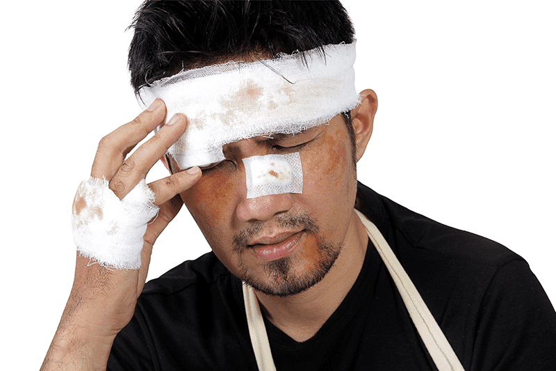 concussion injury attorney accident