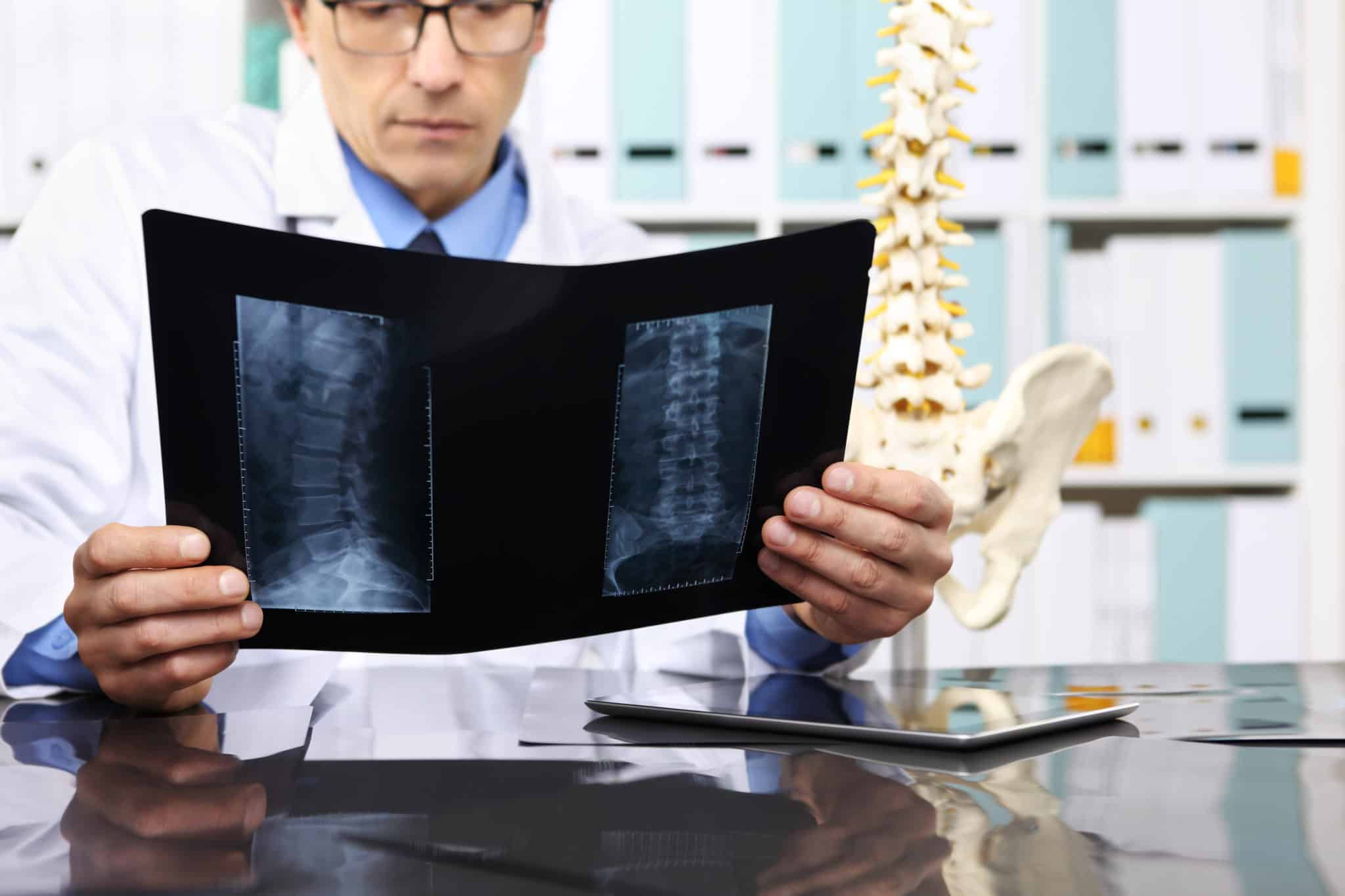 Doctor reviewing spinal X-rays at a medical office, highlighting the role of medical evidence in personal injury cases.